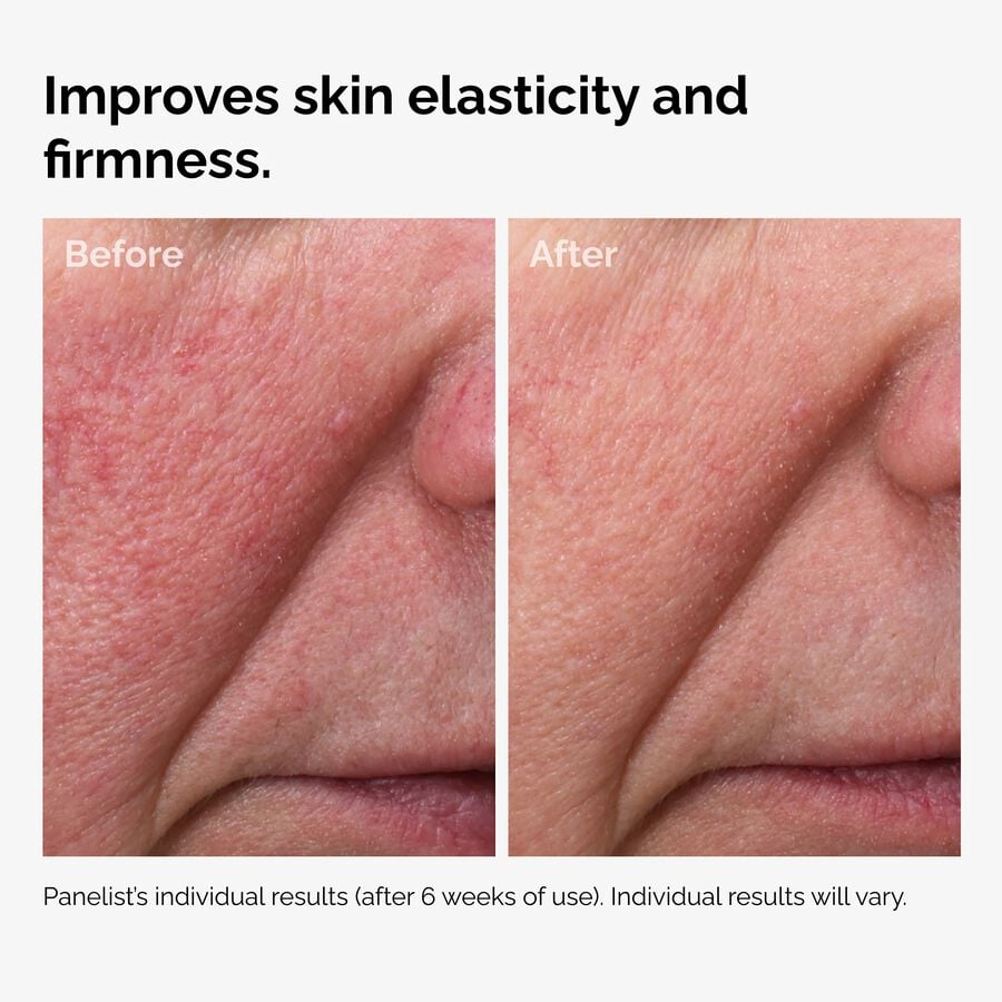 Before and After showing how 100% Fermented Rose Hip Seed Oil improves elasticity and firmness