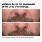 Before and After showing how 100% Fermented Rose Hip Seed Oil reduces fine lines and wrinkles