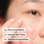 Model Application of the Aloe 2% + NAG 2% Solution