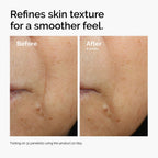 Before and after comparison of skin texture. After 8 weeks of twice-daily use of Caffeine 3% + Escin 1% Face Serum, the skin surface appears visibly smoother and more refined.