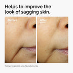 Before and after comparison showing improvements in the look of sagging skin. After 8 weeks of using Caffeine 3% + Escin 1% Face Serum twice daily, the appearance of skin laxity is visibly reduced.