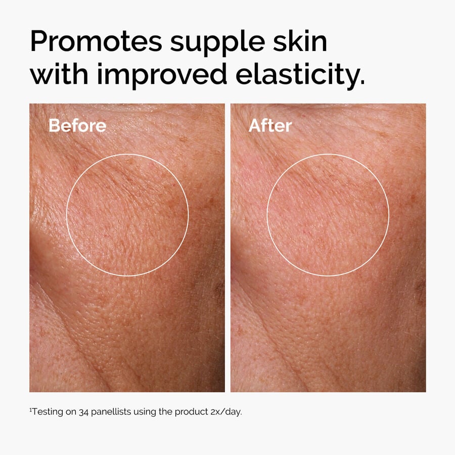 Before and after showing improved skin elasticity with twice daily use.