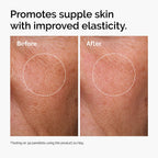 Before and after showing improved skin elasticity with twice daily use.