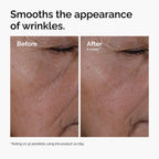 Before and after close-up showing the reduction in the appearance of wrinkles after 8 weeks of using Multi-Peptide + HA Serum.