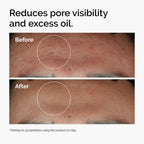 Before and after using Niacinamide 10% + Zinc 1%  to reduce oil and minimize pores.
