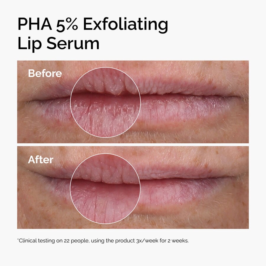 Before and After graphic showing smoother less flakly lips after using PHA 5% Lip Exfoliating Serum