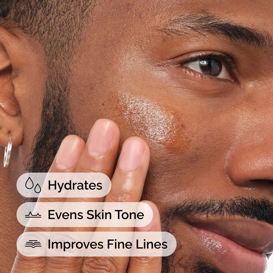 Application of The Ordinary Retinol 1% in Squalane